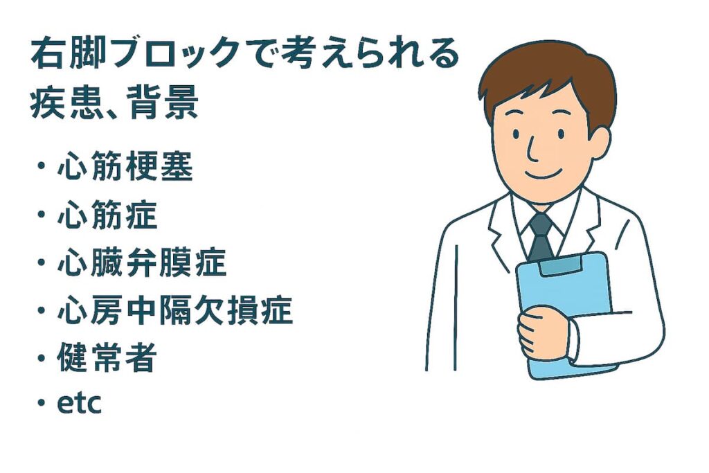医師が右脚ブロックで考えられる病気などを説明しています。
