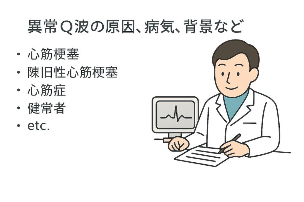 心電図、異常Q波の原因、背景などを医師が説明しています。
