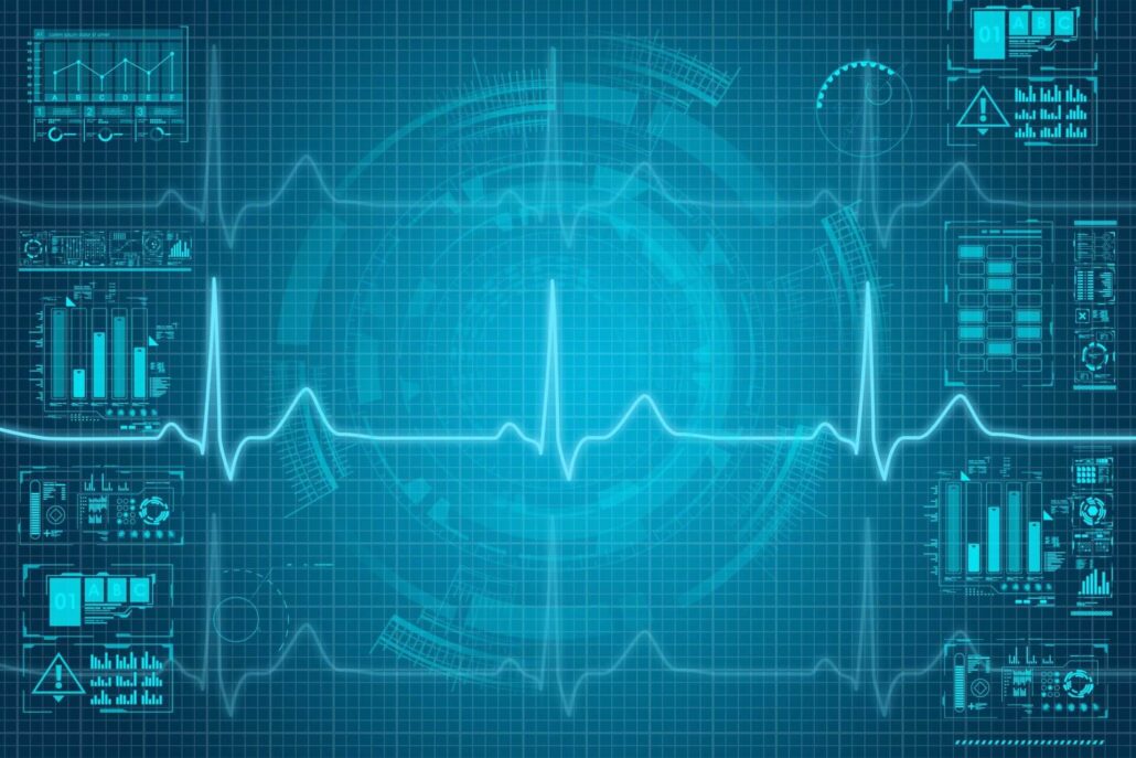 心電図とそのデータイメージ画像